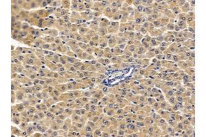 ABIN7094050 and ABIN7098094 at 1/100 staining rat liver tissue by IHC-P. (SOAT2 anticorps  (C-Term))
