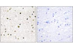Immunohistochemistry analysis of paraffin-embedded human brain tissue, using AKAP11 Antibody. (AKAP11 anticorps  (AA 1761-1810))