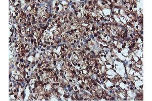 Image no. 5 for anti-Dual Specificity Phosphatase 23 (DUSP23) antibody (ABIN1497930) (DUSP23 anticorps)