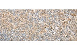 Immunohistochemistry of paraffin-embedded Human tonsil tissue using PSMD12 Polyclonal Antibody at dilution of 1:40(x200) (PSMD12 anticorps)