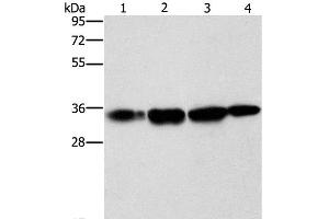 Western Blot analysis of Hela cell and Human prostate tissue, A172 cell and Mouse liver tissue using NSMCE3 Polyclonal Antibody at dilution of 1:1500 (Necdin-Like 2 anticorps)
