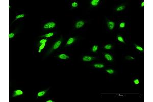 Immunofluorescence of monoclonal antibody to ZIC4 on HeLa cell. (ZIC4 anticorps  (AA 1-90))