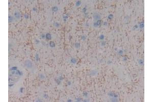 Detection of MBP in Human Cerebrum Tissue using Polyclonal Antibody to Myelin Basic Protein (MBP) (MBP anticorps  (AA 135-190))