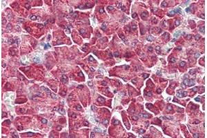 Human Pancreas (formalin-fixed, paraffin-embedded) stained with MAP3K5 antibody ABIN461897 at 5 ug/ml followed by biotinylated goat anti-rabbit IgG secondary antibody ABIN481713, alkaline phosphatase-streptavidin and chromogen.