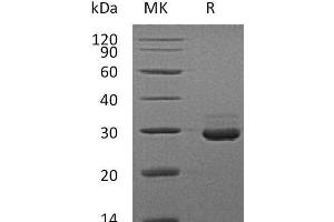 Western Blotting (WB) image for V-Set and Immunoglobulin Domain Containing 8 (VSIG8) protein (His tag) (ABIN7320683)
