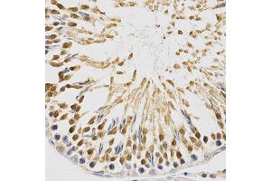 Immunohistochemistry (IHC) image for anti-Nuclear Factor (erythroid-Derived 2)-Like 2 (NFE2L2) (AA 366-605) antibody (ABIN3021832)