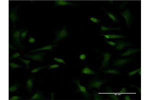 Immunofluorescence of monoclonal antibody to LYPLA1 on HeLa cell. (LYPLA1 anticorps  (AA 66-151))