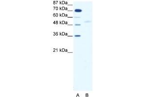 WB Suggested Anti-SMAD5 Antibody   Titration: 2. (SMAD5 anticorps  (Middle Region))