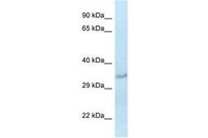 Image no. 1 for anti-Sulfotransferase Family, Cytosolic, 1C, Member 2 (SULT1C2) (AA 70-119) antibody (ABIN6747528) (SULT1C2 anticorps  (AA 70-119))