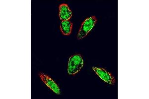 Confocal immunofluorescent analysis of SRC Antibody (N-term) (ABIN392107 and ABIN2841859) with  cell followed by Alexa Fluor 488-conjugated goat anti-rabbit lgG (green).
