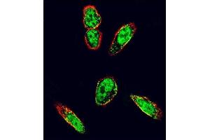 Confocal immunofluorescent analysis of SRC Antibody (N-term) (ABIN392107 and ABIN2841859) with  cell followed by Alexa Fluor 488-conjugated goat anti-rabbit lgG (green). (Src anticorps  (N-Term))