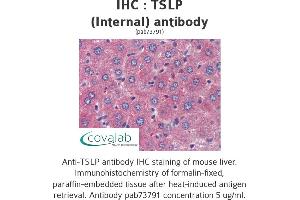 Image no. 1 for anti-Thymic Stromal Lymphopoietin (TSLP) (Internal Region) antibody (ABIN1740423) (Thymic Stromal Lymphopoietin anticorps  (Internal Region))