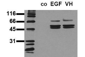 Western Blotting (WB) image for anti-SHC (Src Homology 2 Domain Containing) Transforming Protein 1 (SHC1) (pTyr239), (pTyr240) antibody (ABIN126888) (SHC1 anticorps  (pTyr239, pTyr240))