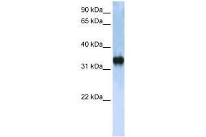 ZCCHC17 antibody used at 1 ug/ml to detect target protein. (ZCCHC17 anticorps  (C-Term))