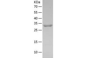 Western Blotting (WB) image for Melanoma Antigen Family A, 3 (MAGEA3) (AA 1-314) protein (His tag) (ABIN7123887) (MAGEA3 Protein (AA 1-314) (His tag))