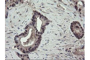 Image no. 6 for anti-TSC22 Domain Family, Member 1 (TSC22D1) antibody (ABIN1501535) (TSC22D1 anticorps)