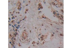 Used in DAB staining on fromalin fixed paraffin- embedded breast cancer tissue (DTYMK anticorps  (AA 43-190))