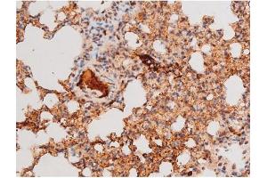 ABIN6267578 at 1/200 staining Mouse lung tissue sections by IHC-P.
