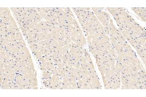 Detection of HIF1a in Bovine Cardiac Muscle Tissue using Polyclonal Antibody to Hypoxia Inducible Factor 1 Alpha (HIF1a)