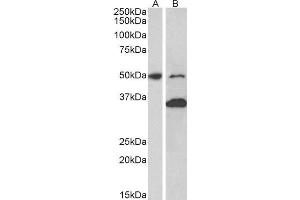 ABIN2563878 (1µg/ml) staining of Mouse fetal (A) and adult (B) Brain lysates (35µg protein in RIPA buffer). (MKRN1 anticorps  (AA 105-118))