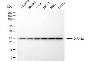 Western blotting analysis using DIRAS2 antibody (ABIN7798351).