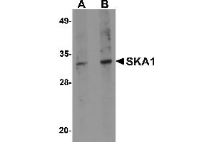 Western blot analysis of SKA1 in A549 cell lysate with SKA1 antibody at (A) 0. (SKA1 anticorps  (C-Term))