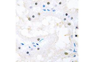 Immunohistochemical analysis of FOXC1/2 staining in human kidney formalin fixed paraffin embedded tissue section.