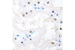 Immunohistochemical analysis of FOXC1/2 staining in human kidney formalin fixed paraffin embedded tissue section. (FOXC1 anticorps  (Center))