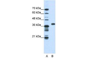 WB Suggested Anti-PCBP1  Antibody Titration: 1. (PCBP1 anticorps  (Middle Region))