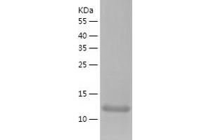 Western Blotting (WB) image for Ubiquitin-Conjugating Enzyme E2A (ube2a) (AA 1-152) protein (His-IF2DI Tag) (ABIN7124771)