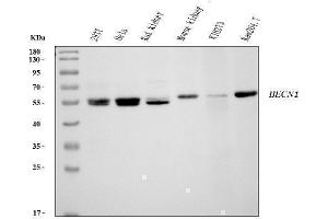Western blot analysis of Beclin 1 using anti-Beclin 1 antibody (ABIN7599303).
