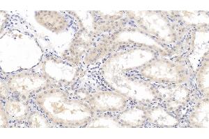 Detection of b2M in Human Kidney Tissue using Monoclonal Antibody to Beta-2-Microglobulin (b2M) (beta-2 Microglobulin anticorps  (AA 22-119))
