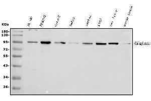 Western blot analysis of Plasminogen using anti-Plasminogen antibody (ABIN6719276).