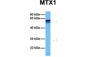Host:  Rabbit  Target Name:  MTX1  Sample Tissue:  Human Ovary Tumor  Antibody Dilution:  1. (Metaxin 1 anticorps  (C-Term))