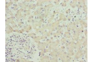 Immunohistochemistry of paraffin-embedded human liver tissue using ABIN7169619 at dilution of 1:100