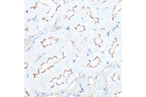 Immunohistochemistry of paraffin-embedded mouse kidney using SSTR5 Rabbit mAb (ABIN7270495) at dilution of 1:100 (40x lens). (SSTR5 anticorps)