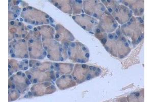 Detection of IL6 in Rat Pancreas Tissue using Monoclonal Antibody to Interleukin 6 (IL6)