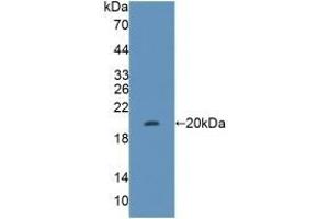 Detection of Recombinant FUM, Human using Polyclonal Antibody to Fumarase (FUM)