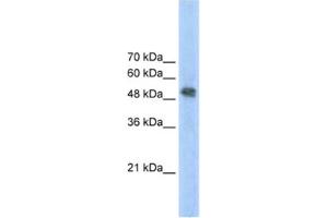 Western Blotting (WB) image for anti-Ferrochelatase (FECH) antibody (ABIN2462452)