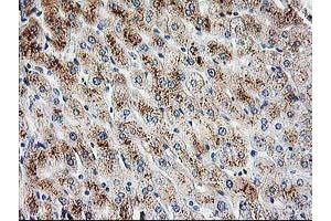 Immunohistochemical staining of paraffin-embedded Human liver tissue using anti-PBX1 mouse monoclonal antibody. (PBX1 anticorps)