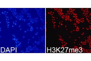 Immunofluorescence analysis of 293T cell using H3K27me3 antibody. (Histone 3 anticorps  (H3K27me))