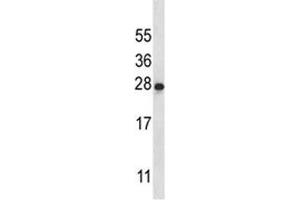 IL-22 antibody western blot analysis in K562 lysate (IL-22 anticorps  (AA 44-73))
