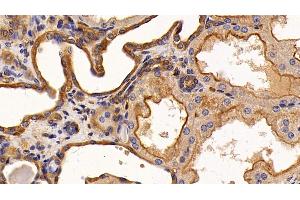 Detection of EGFR in Human Kidney Tissue using Monoclonal Antibody to Epidermal Growth Factor Receptor (EGFR) (EGFR anticorps  (AA 888-1210))