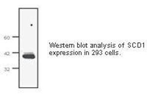 Image no. 1 for anti-Stearoyl-CoA Desaturase (Delta-9-Desaturase) (SCD) antibody (ABIN207646) (SCD anticorps)