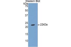 Detection of Recombinant IGFBP1, Porcine using Polyclonal Antibody to Insulin Like Growth Factor Binding Protein 1 (IGFBP1) (IGFBPI anticorps  (AA 112-262))