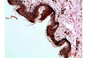 Immunohistochemical analysis of paraffin-embedded human-skin, antibody was diluted at 1:200