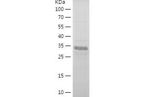 Western Blotting (WB) image for Cyclin-Dependent Kinase Inhibitor 1B (p27, Kip1) (CDKN1B) (AA 90-197) protein (His-IF2DI Tag) (ABIN7122537)
