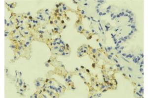 ABIN6273909 at 1/100 staining Mouse lung tissue by IHC-P. (SSTR4 anticorps  (C-Term))