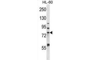 Western Blotting (WB) image for anti-Matrix Metallopeptidase 15 (Membrane-inserted) (MMP15) antibody (ABIN2997513) (MMP15 anticorps)