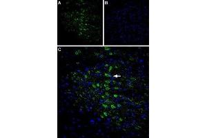 Expression of CaVγ6 (CACNG6) in rat brain - Immunohistochemical staining of rat cingulate cortex using Anti-CACNG6 (extracellular) Antibody (ABIN7042994, ABIN7044055 and ABIN7044056), (1:400). (CACNG6 anticorps  (1st Extracellular Loop))